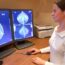 Mamografías: detectar el cáncer de mama a tiempo puede salvar vidas