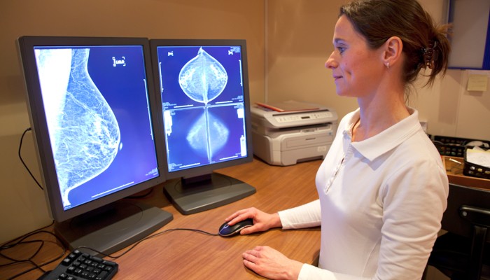 Mamografías: detectar el cáncer de mama a tiempo puede salvar vidas